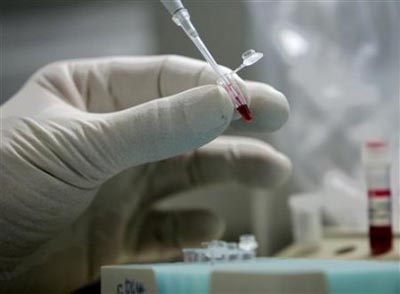 H1N1 vakcina